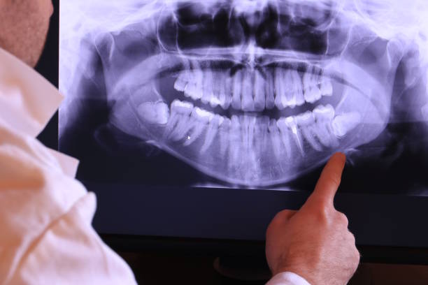 Best Emergency Tooth Extraction  in Thornport, OH