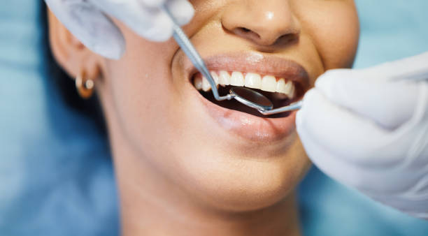 Best Teeth Whitening  in Thornport, OH